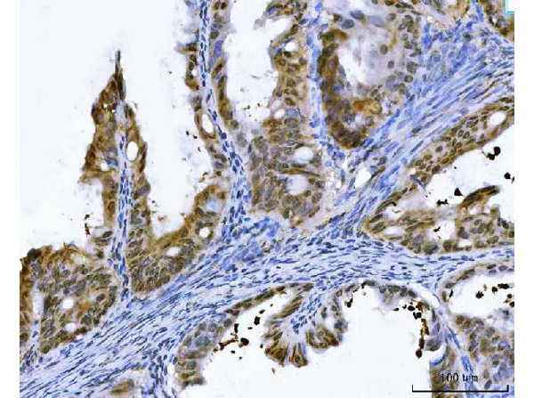 Immunohistochemistry analysis of GSTP1