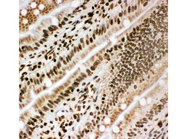 Immunohistochemistry analysis of Lamin B1