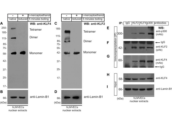 Western Blot using Lamin B1