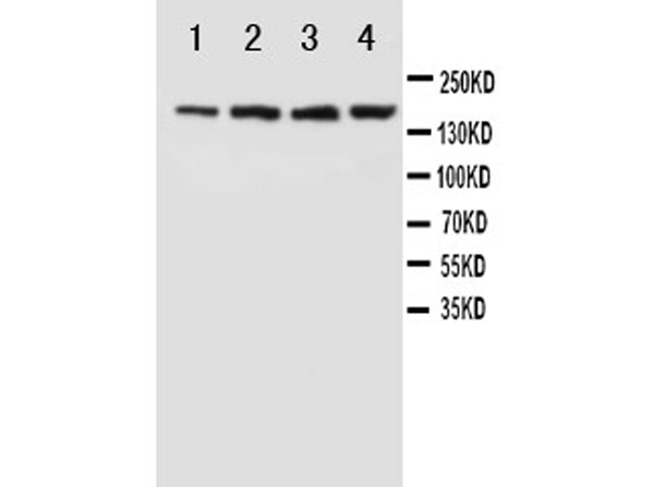 Western blotting of Anti-NMDAR2B antibody