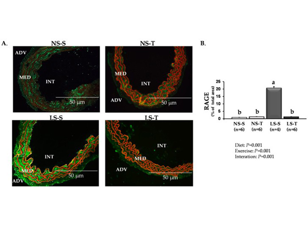 Immunofluorescence using RAGE