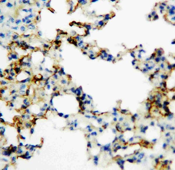 Immunohistochemistry of Anti-RAGE antibody