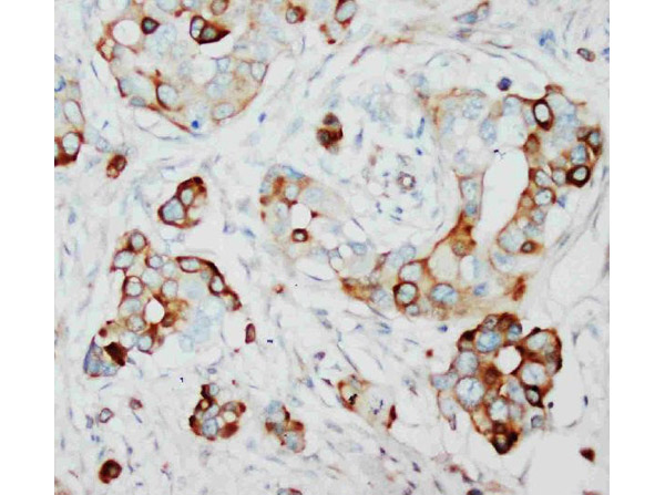 Immunohistochemistry of Anti-SKP2 antibody