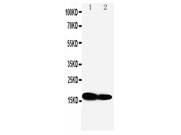 Western blot of Anti-IFITM1 antibody