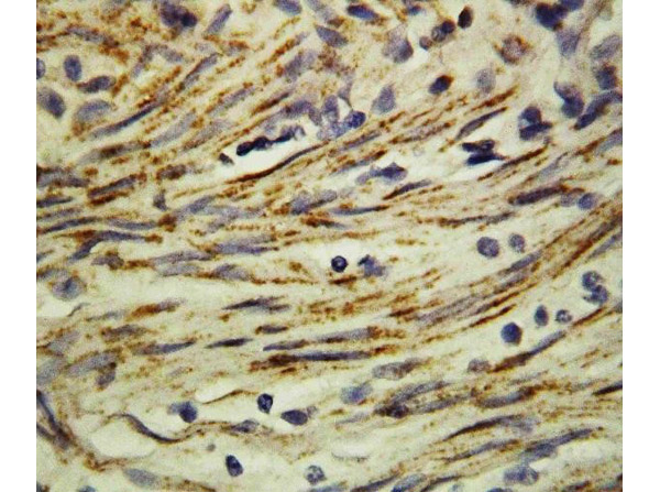 Immunohistochemistry analysis of MMP16