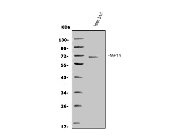 Western blot analysis of MMP16