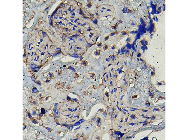 Immunohistochemistry analysis of MMP16