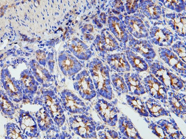 Immunohistochemistry analysis of MMP16