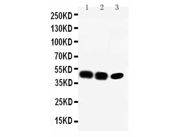 Western blotting of Anti-CCR6 antibody