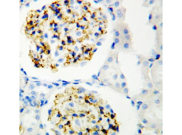 Immunohistochemistry analysis of CD34