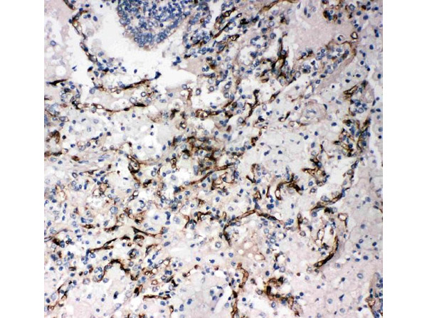 Immunohistochemistry analysis of CD34