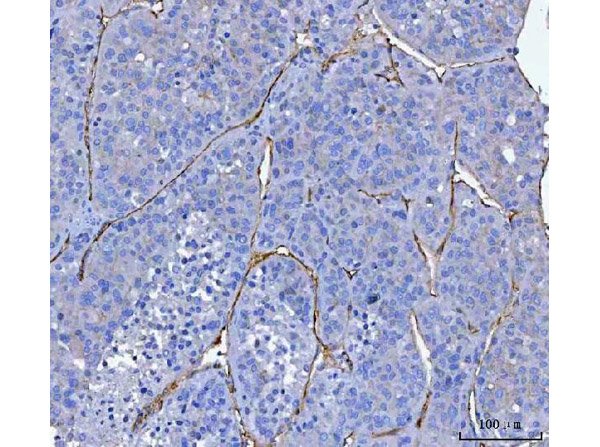 Immunohistochemistry analysis of CD34