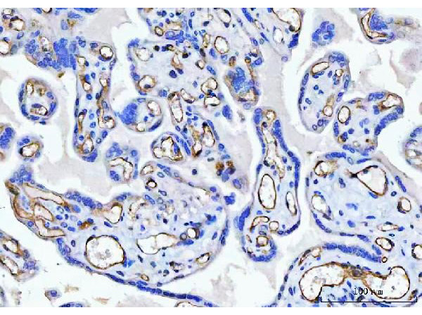 Immunohistochemistry analysis of CD34