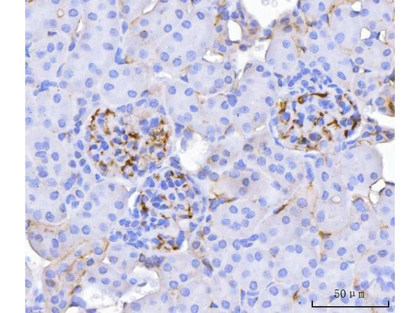 Immunohistochemistry analysis of CD34