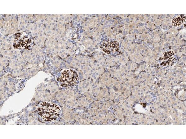 Immunohistochemistry analysis of CD34