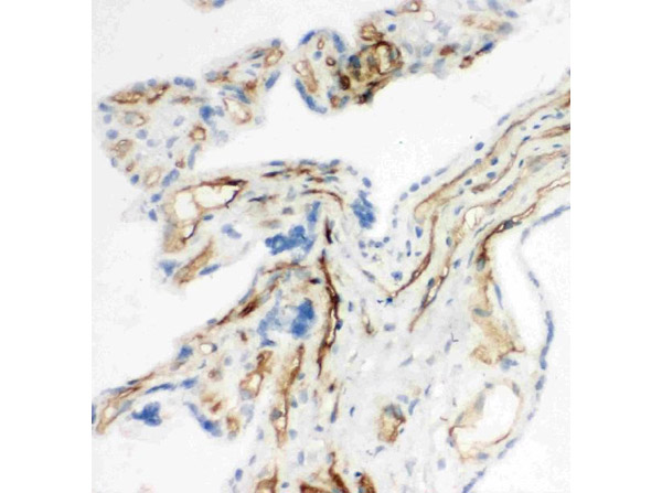 Immunohistochemistry analysis of CD34