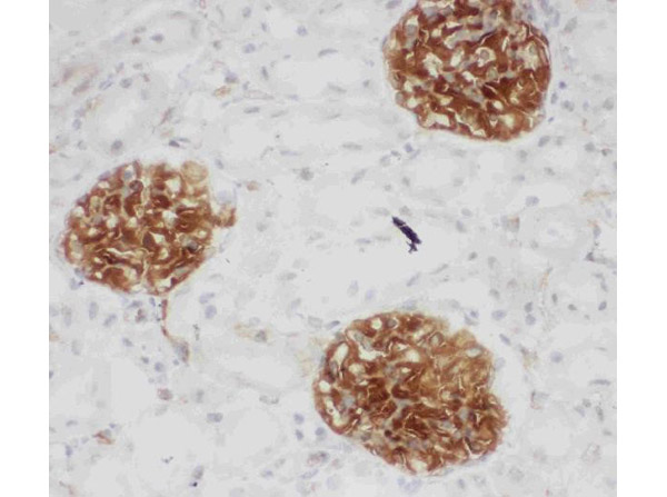 Immunohistochemistry analysis of CD34