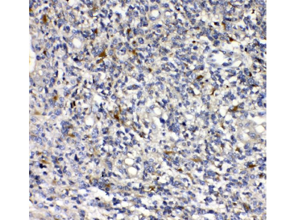 Immunohistochemistry analysis of PLAUR