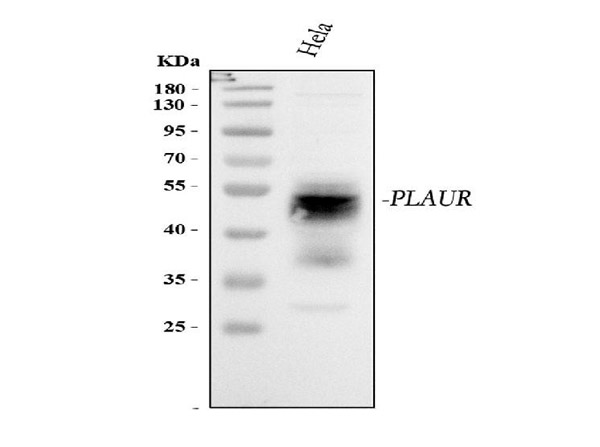 Western blot analysis of PLAUR