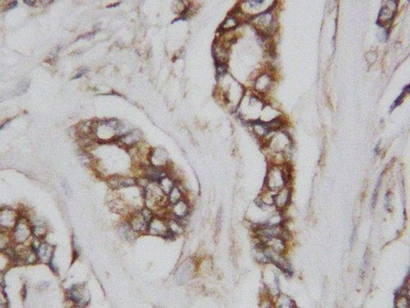 Immunohistochemistry of Anti-CDC42