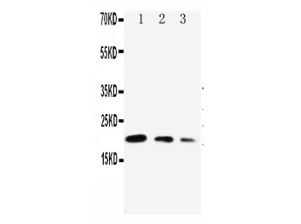 Western blotting of Anti-CDC42