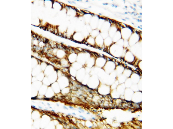 Immunohistochemistry of Anti-TIMP-1