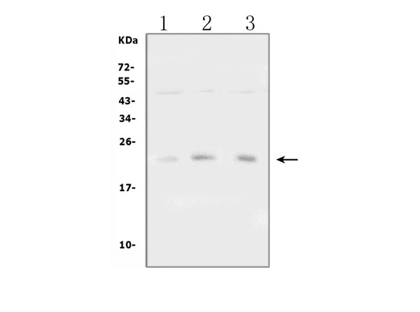 Western blot analysis of TIMP1