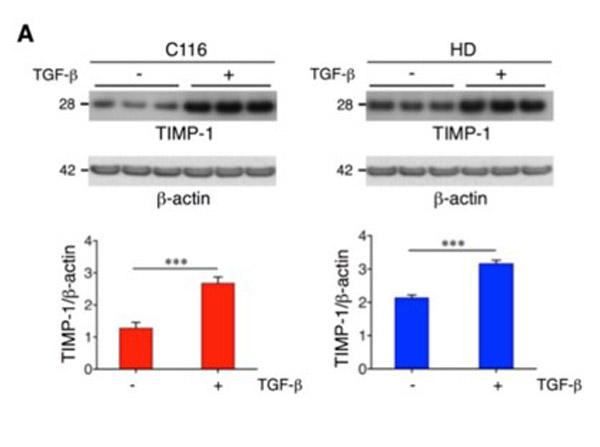 Western blot analysis of TIMP1