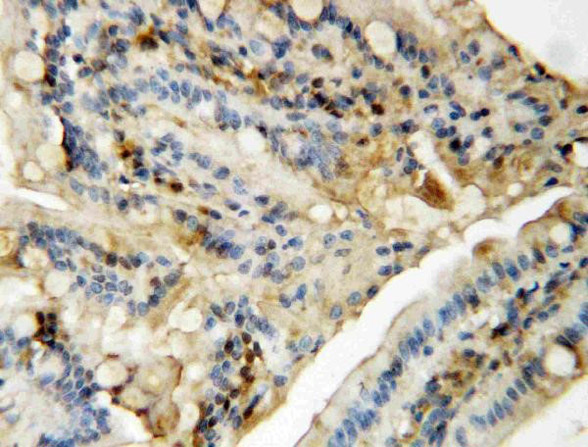 Immunohistochemistry of Anti-MAPK8/9