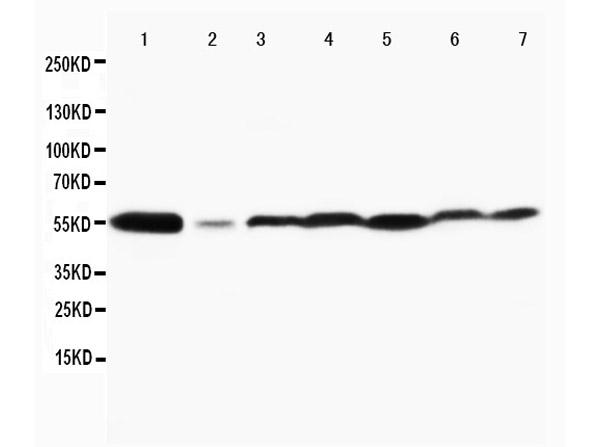 Western blotting of Anti-MAPK 8/9