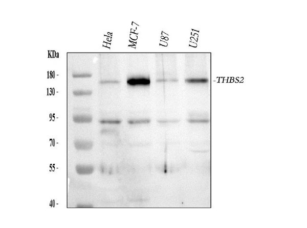 Western blot analysis of THBS2