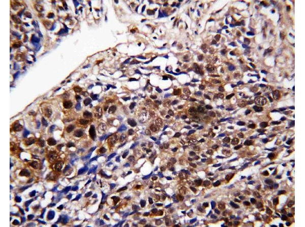 Immunohistchemistry analysis of DDT