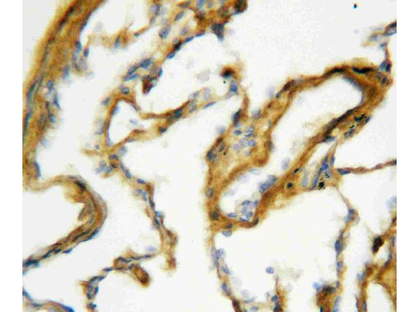 Immunohistochemistry of analysis of SFTPA1