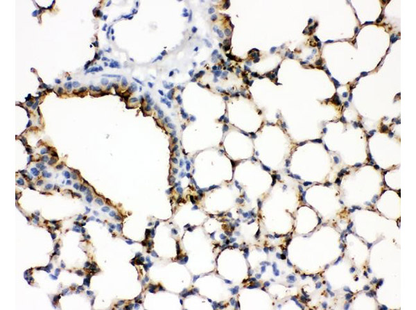 Immunohistochemistry of analysis of SFTPA1