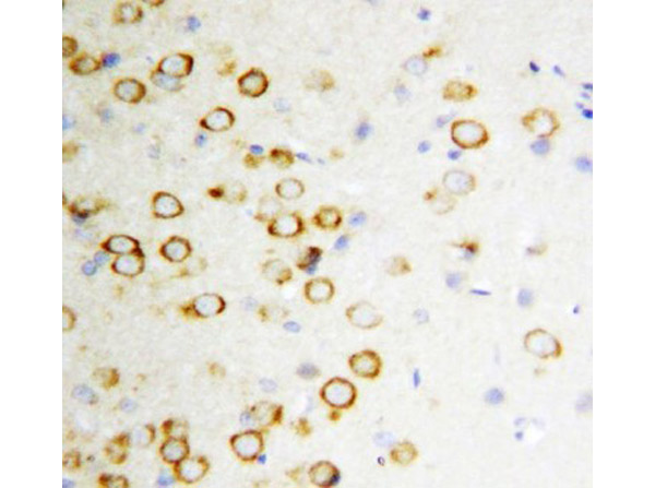 Immunohistochemistry of Anti-GDNF