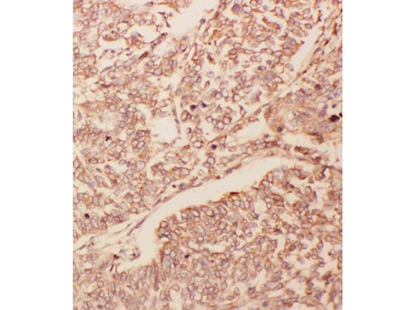 Immunohistochemistry of Anti-GDNF