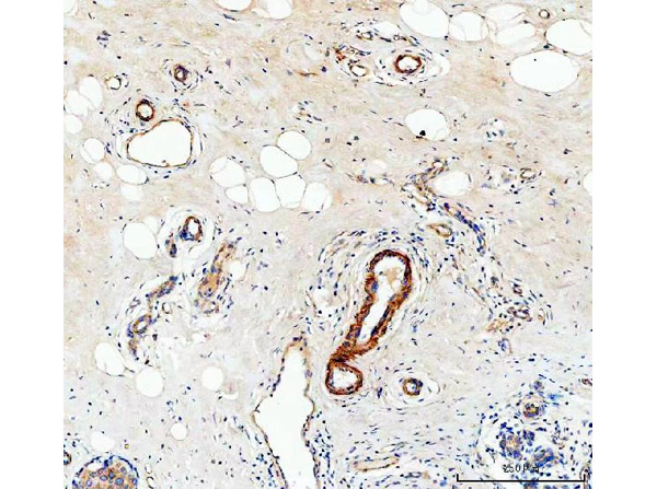 Immunohistochemistry analysis of Canstatin