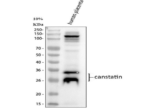 Western blot analysis of Canstatin