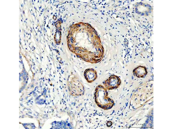 Immunohistochemistry analysis of Canstatin