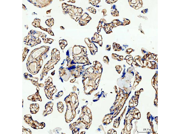 Immunohistochemistry analysis of Canstatin