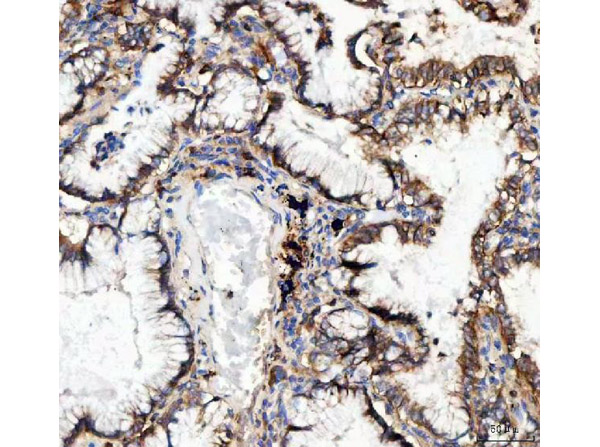 Immunohistochemistry analysis of ITGA3