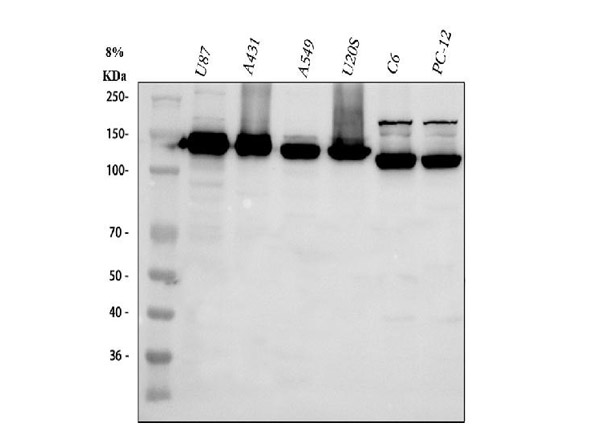 Western blot analysis of ITGA3