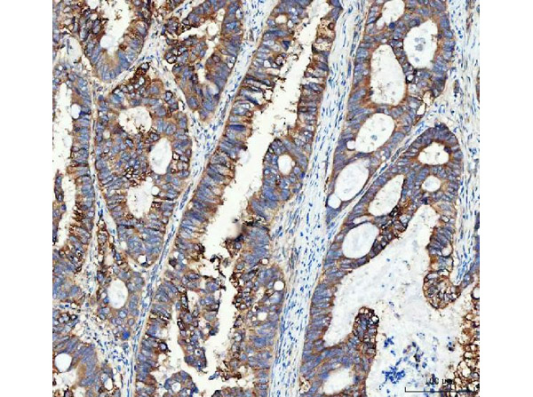 Immunohistochemistry analysis of ITGA3