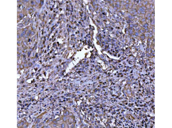 Immunohistochemistry analysis of NLRP3