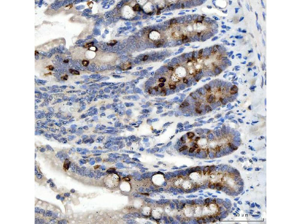 Immunohistochemistry analysis of NOX1