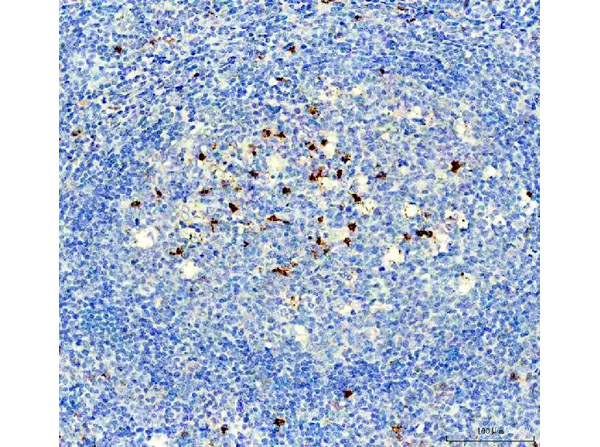 Immunohistochemistry analysis of NOX2