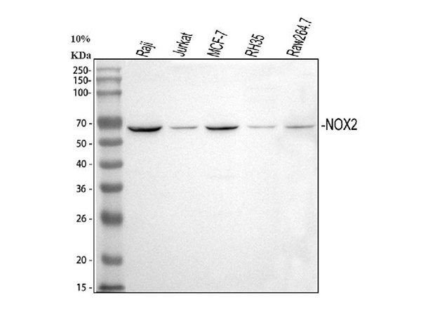 Western blot analysis analysis of NOX2