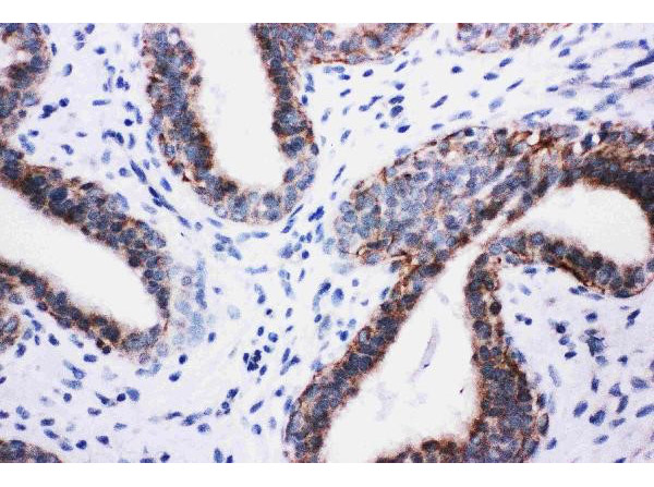 Immunohistochemistry analysis of PIK3R2