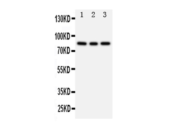 Western blot analysis of PIK3R2