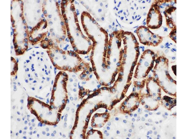 Immunohistochemistry analysis of Anti-SLC22A6